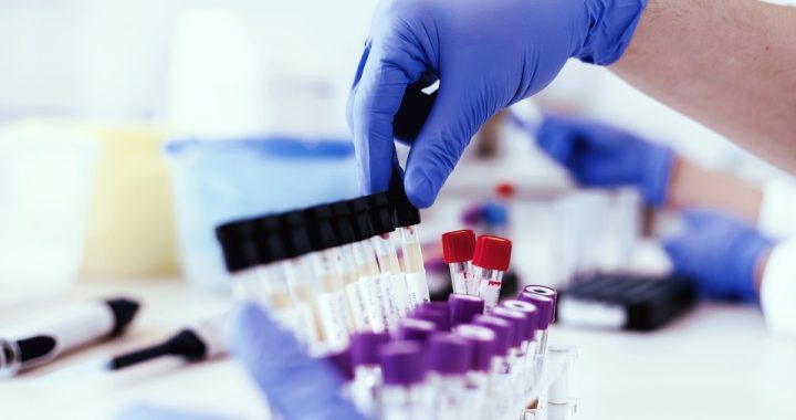 Blazing Trails to Success: Tips and Tricks for Acing a Weed Drug Test!